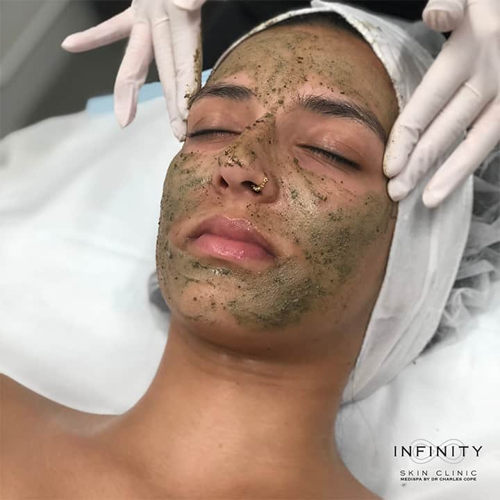 skin peels treatment at infinity clinic - page image 001