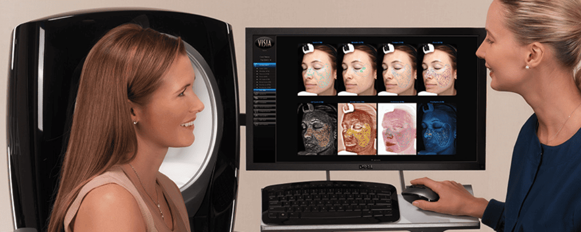 What is a Visia Skin Analysis System and why should you consider having one? - 1