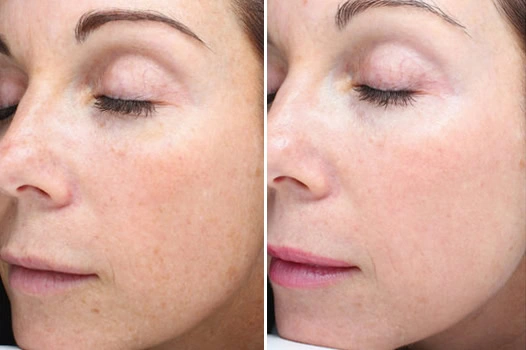 Follow our Instagram and Facebook - 7